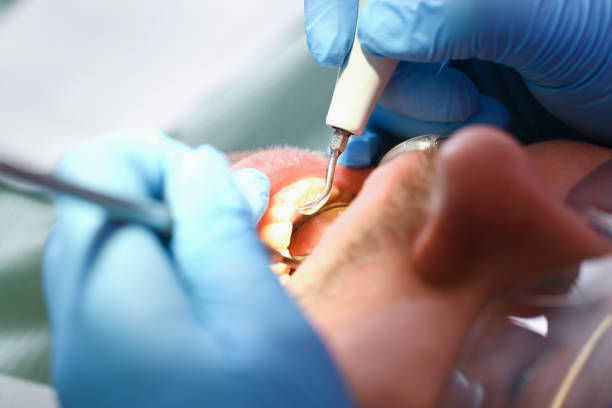 Best Emergency Gum Treatment in Westlake, TX