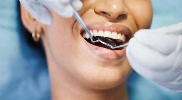 Best Emergency Tooth Extraction in Westlake, TX