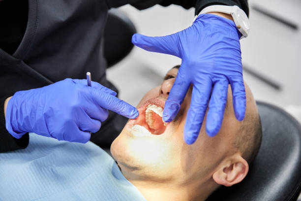 Best Emergency Wisdom Teeth Removal in Westlake, TX
